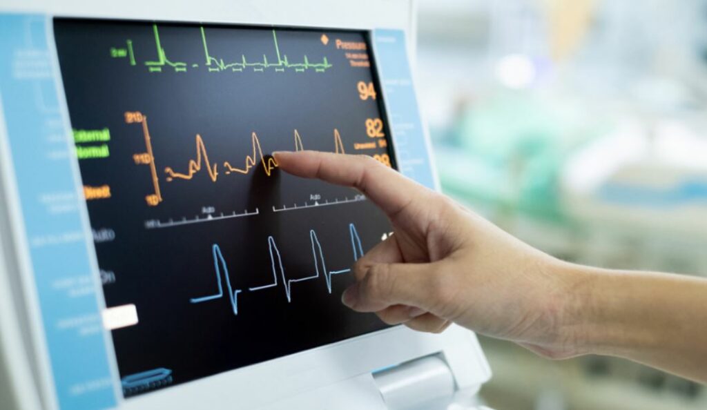 Elektrokardiogram Kesehatan Untuk Smartwatch Apple