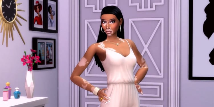 The Sims 4 Vitiligo Winnie Harlow