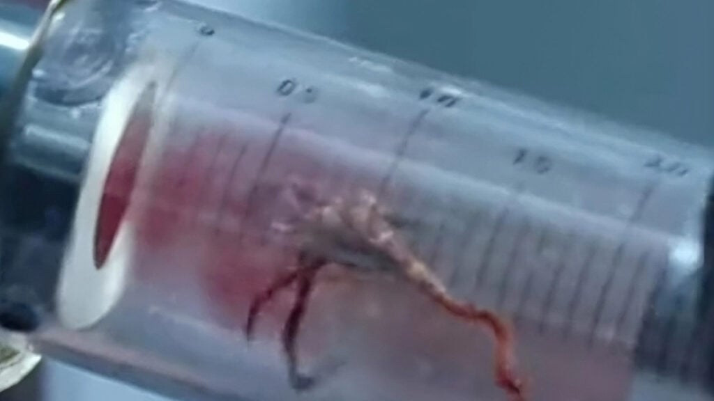 Fans Resident Evil Kaget Ada Pena 'Aneh' di Dalamnya Parasit Asli 2 Fans Resident Evil